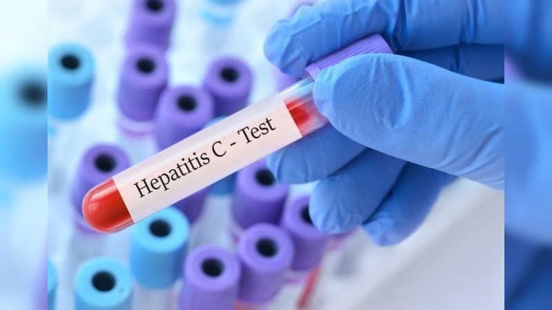 Convocan a pacientes con hepatitis C de Córdoba para iniciar tratamientos de curación definitiva