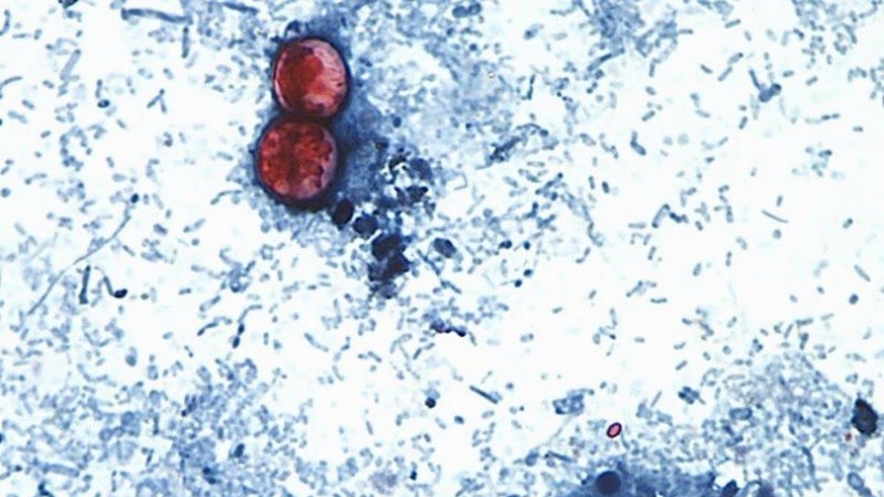 Reportan las primeras dos muertes por brote de ciclosporiasis en Estados Unidos
