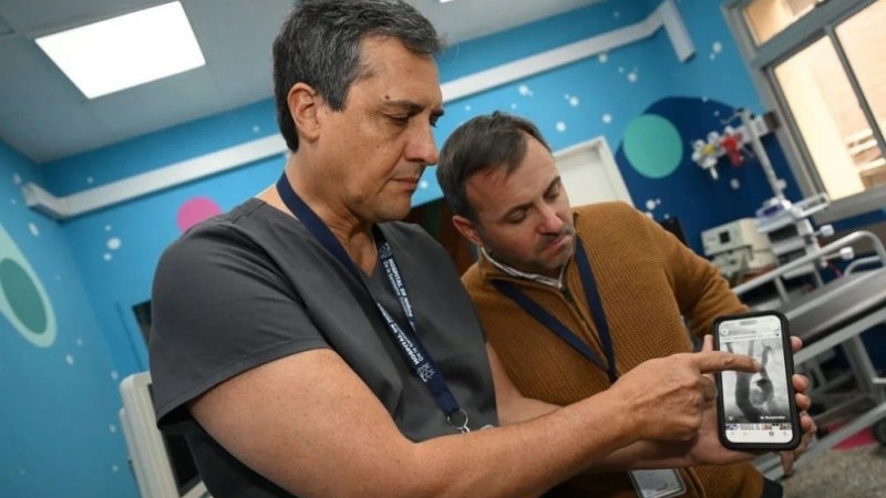 El Hospital de Niños volvió a hacer historia: se colocó el primer stent completamente bioabsorbible en coartación de aorta en el país
