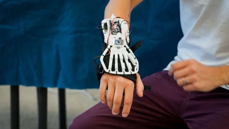 Estudiantes cordobeses crearon una mano robótica para rehabilitación